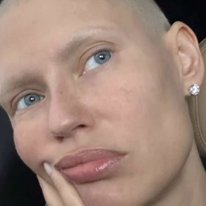 “Senza pillole salvavita contro il cancro non posso lavorare. È inaccettabile, datevi una mossa”: Bianca Balti si sfoga contro le industrie farmaceutiche