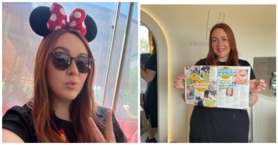 Copertina di “Pensavo fosse il solito brufolo sul naso, lo schiacciavo e ricompariva. Poi mi sono ritrovata con un grosso buco nero”: la storia di Kery-Ann Buckell. Cos’è il carcinoma basocellulare