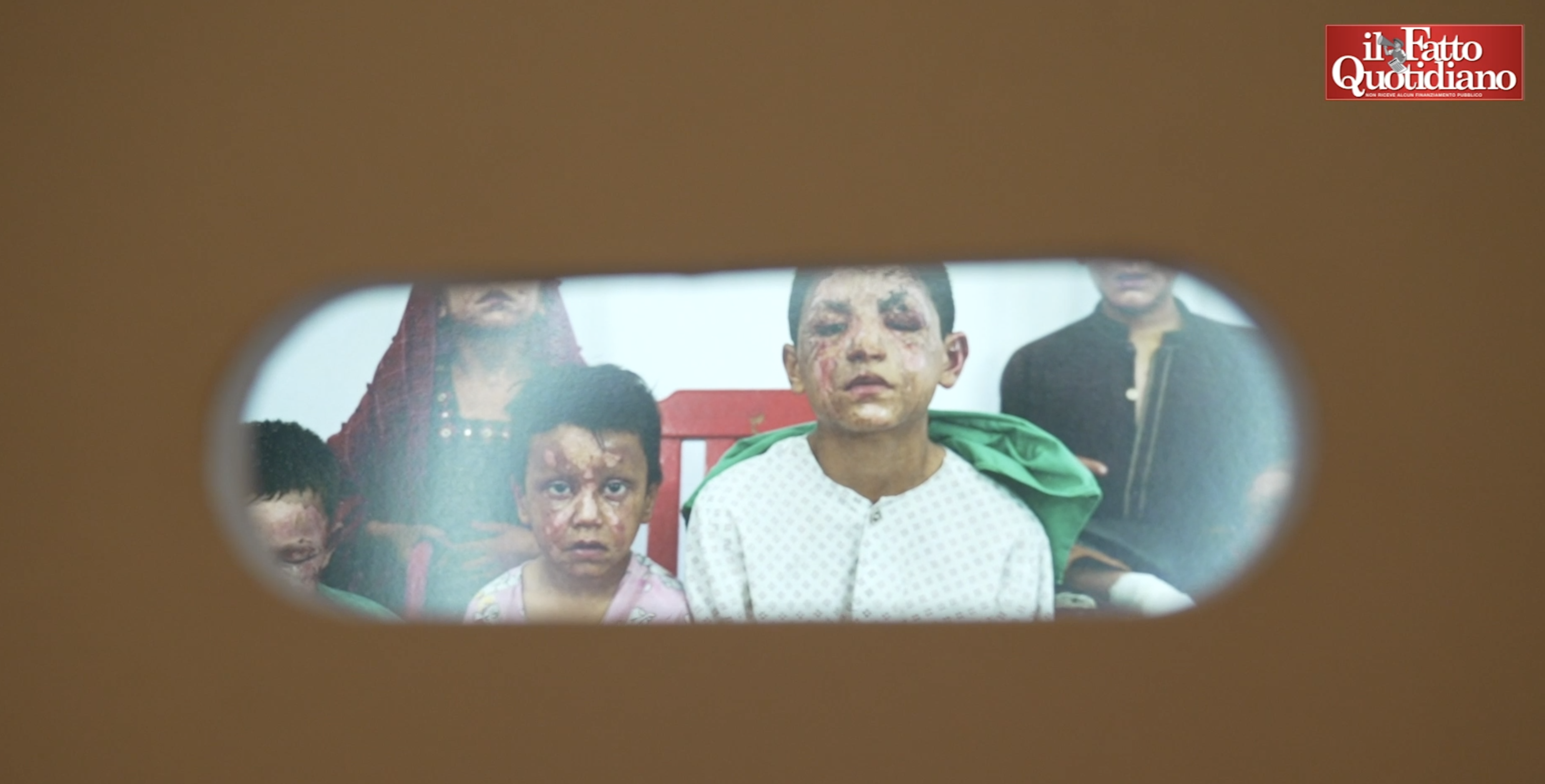 Le fotografie senza tempo di Emergency e i poster di Cheap, a Roma la mostra ‘Contro la guerra’: “Negli anni il dolore è sempre lo stesso” Le fotografie senza tempo di Emergency e i poster di Cheap, a Roma la mostra ‘Contro la guerra’: “Negli anni il dolore è sempre lo stesso”