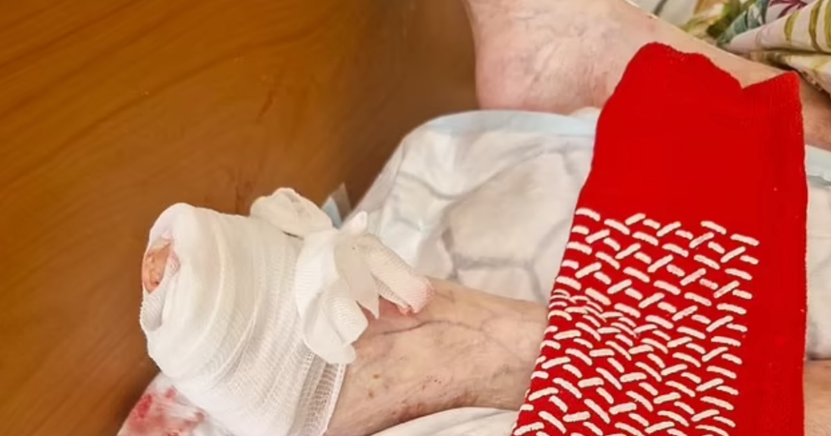 un topo ha mangiato un dito del piede a mia mamma lei dormiva e non si è accorta di nulla siamo sotto choc la denuncia di andrea scott