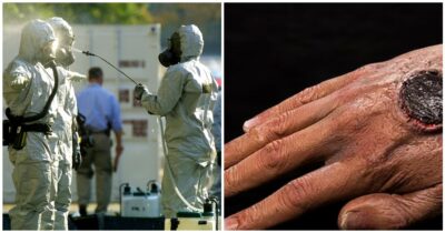 Copertina di Allarme antrace in Thailandia: “Un morto e altre cinque persone infette”. Cos’è l’infezione batterica legata al bioterrorismo