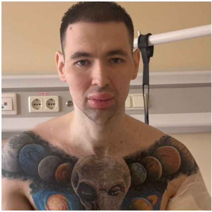 Si inietta l’olio nei bicipiti per renderli più grossi e viene ricoverato d’urgenza in ospedale: l’incidente del “Braccio di Ferro” russo Kirill Tereshin