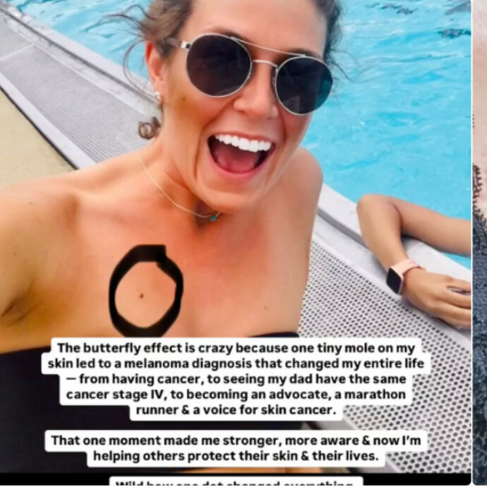 “Pensavo fosse un neo, ma era un cancro che mi ha rovinato la vita. Ho 30 anni e cicatrici su tutto il corpo”: la storia di Leah Alexis Adams