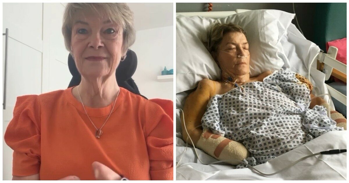 “Mi hanno amputato tutti e quattro gli arti. Una semplice infezione alle vie urinarie si è trasformata in sepsi”: la storia incredibile di Kim Smith