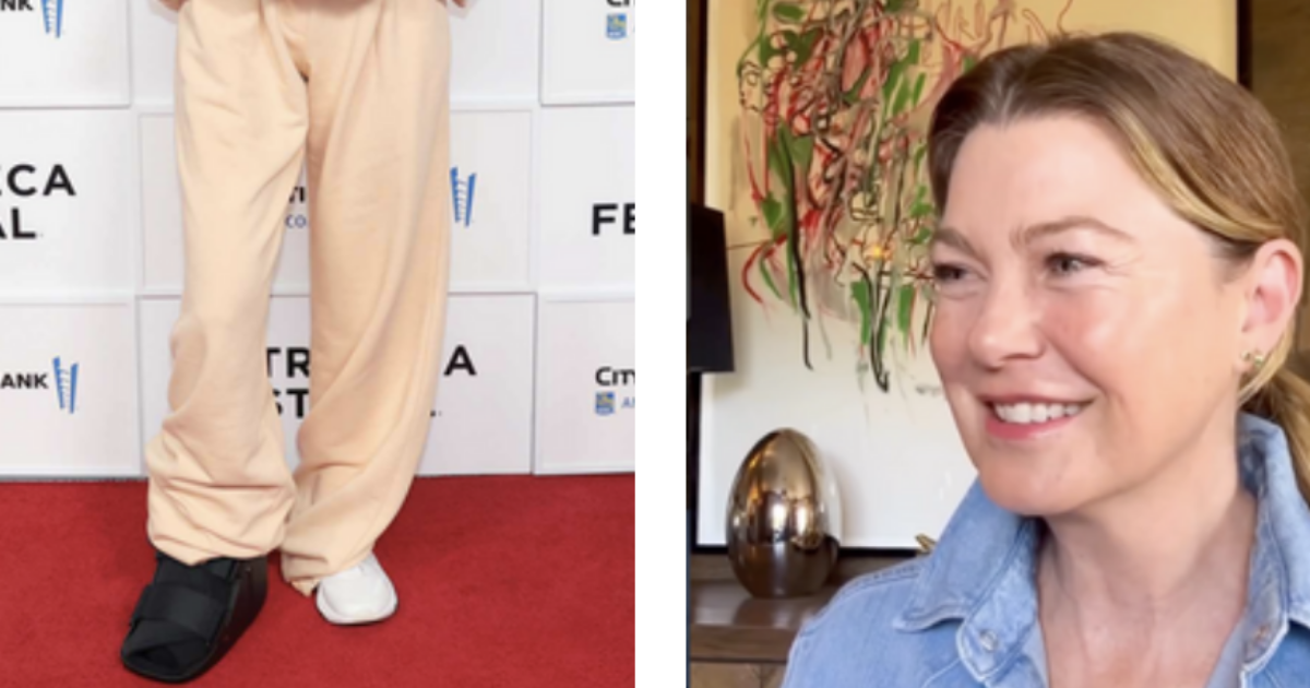 “Cosa ho fatto al piede? Vorrei fosse una storia figa, sexy ma sono solo saltata giù dal letto e ho messo male il piede”: il racconto di Ellen Pompeo