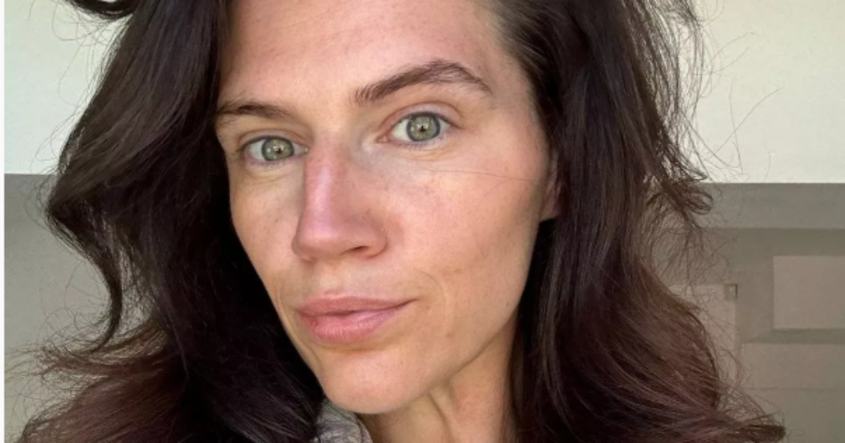 “Ho perso 50 chili in un anno grazie alle punture dimagranti, ma ora tutti mi insultano perché ho la faccia cadente e sembro più vecchia”: la storia di Ashley