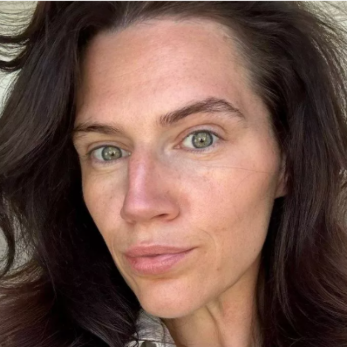 “Ho perso 50 chili in un anno grazie alle punture dimagranti, ma ora tutti mi insultano perché ho la faccia cadente e sembro più vecchia”: la storia di Ashley