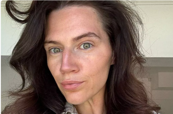 “Ho perso 50 chili in un anno grazie alle punture dimagranti, ma ora tutti mi insultano perché ho la faccia cadente e sembro più vecchia”: la storia di Ashley “Ho perso 50 chili in un anno grazie alle punture dimagranti, ma ora tutti mi insultano perché ho la faccia cadente e sembro più vecchia”: la storia di Ashley