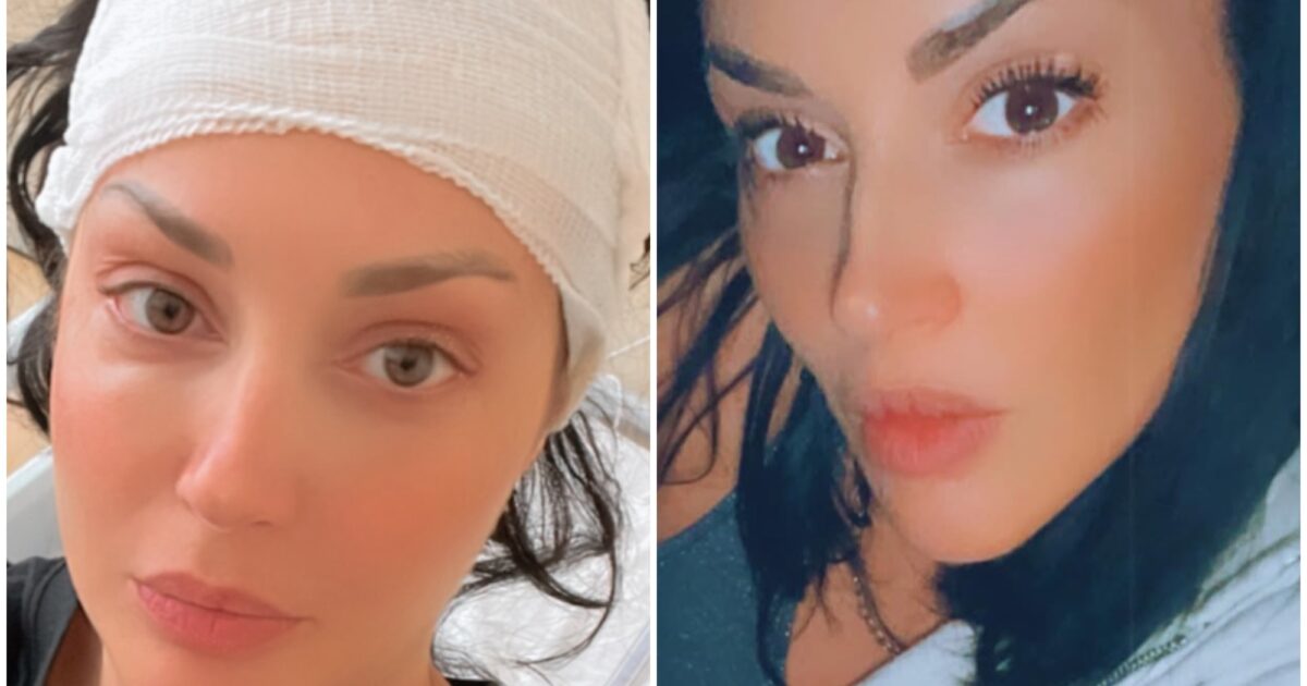 sono stata operata alla testa per 10 12 ore a causa di due lesioni importanti lo rivela diletta pagliano ex protagonista di uomini e donne