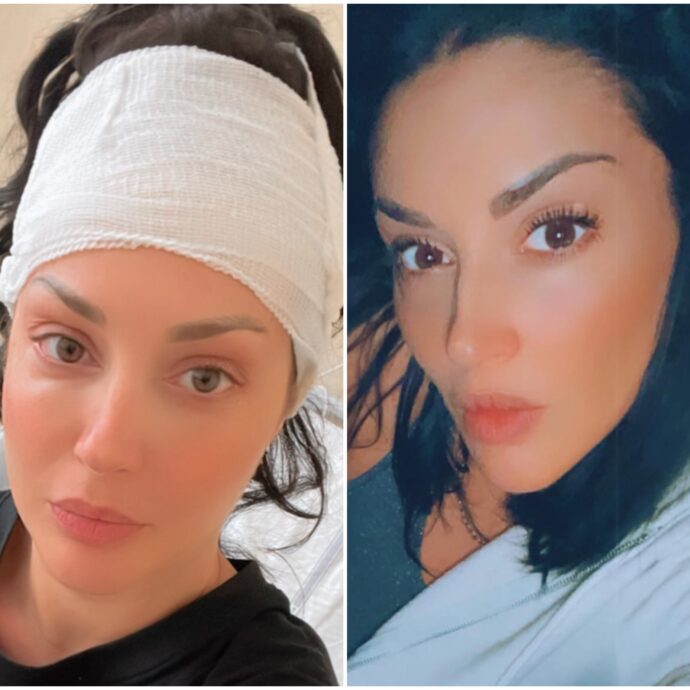 “Sono stata operata alla testa per 10-12 ore a causa di due lesioni importanti”: lo rivela Diletta Pagliano, ex protagonista di “Uomini e Donne”