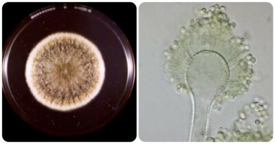Copertina di Da fungo “maledetto” delle tombe a potenziale farmaco anti-cancro. La scoperta sull’Aspergillus flavus