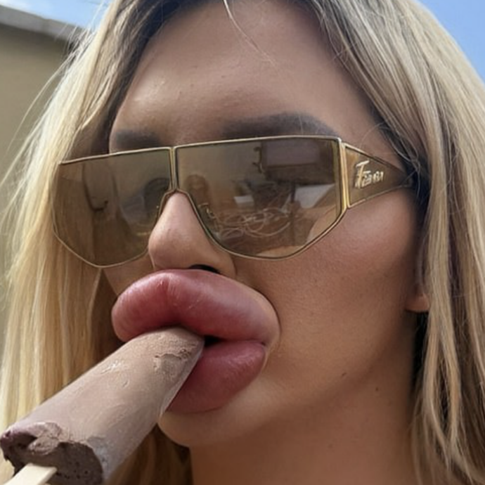 “Ho fatto così tanto filler alle labbra che ho difficoltà a respirare e non riesco a chiudere la bocca. Smettere? Non ci penso proprio”: lo confessa Vienna Würstel