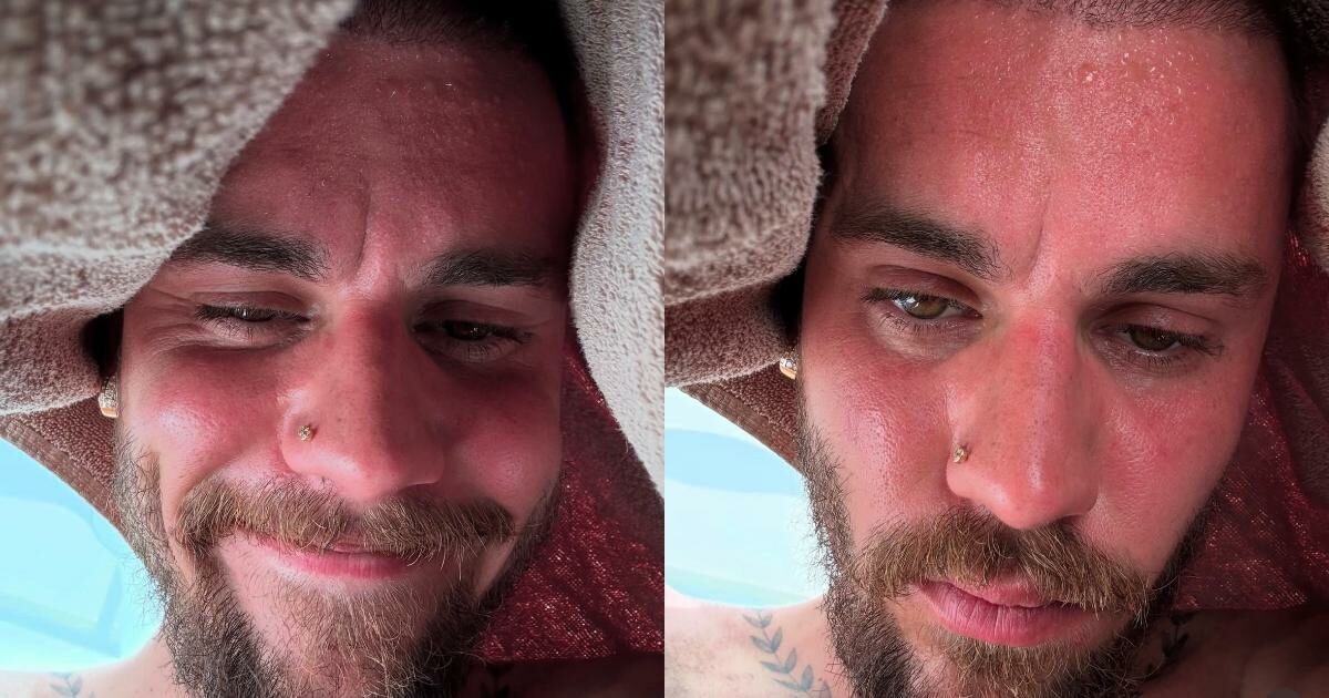 “Non seguire la strada di Britney Spears, concentrati sulla tua salute”: il post criptico di Justin Bieber fa allarmare i fan