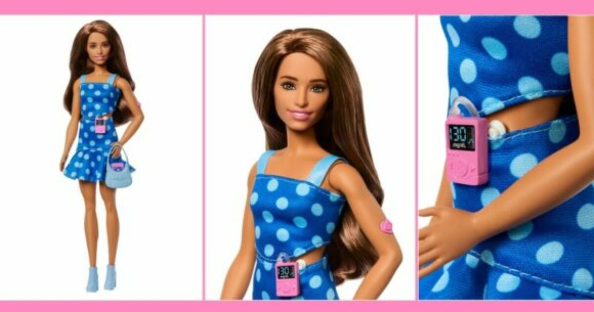 Arriva la Barbie con il diabete di tipo 1. Tra gli accessori il sensore per il monitoraggio della glicemia e la pompa per insulina