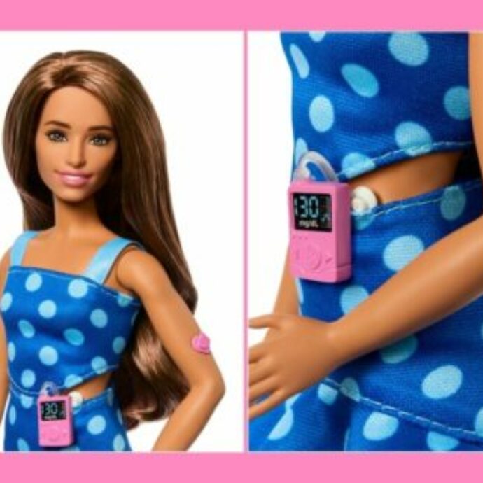 Arriva la Barbie con il diabete di tipo 1. Tra gli accessori il sensore per il monitoraggio della glicemia e la pompa per insulina