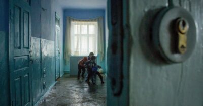 Copertina di Il rachitismo e lo scorbuto: nel Regno Unito la povertà infantile è causa del ritorno di malattie di età vittoriana