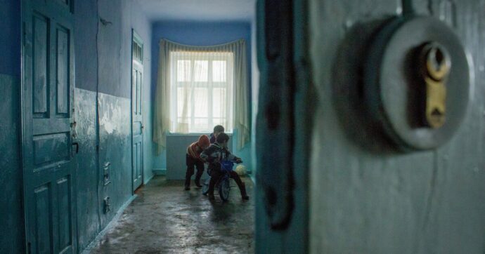 Il rachitismo e lo scorbuto: nel Regno Unito la povertà infantile è causa del ritorno di malattie di età vittoriana