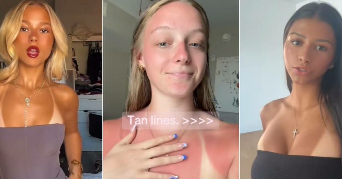 Su TikTok spopola l’”abbronzatura selvaggia” con la gara a mostrare le scottature solari, l’esperto avverte: “È una moda pericolosissima, si rischia il cancro”