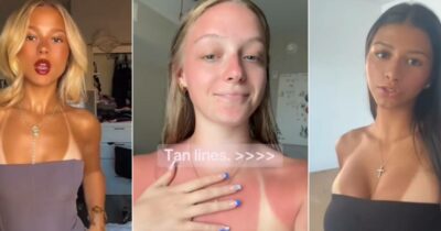 Copertina di Su TikTok spopola l’”abbronzatura selvaggia” con la gara a mostrare le scottature solari, l’esperto avverte: “È una moda pericolosissima, si rischia il cancro”