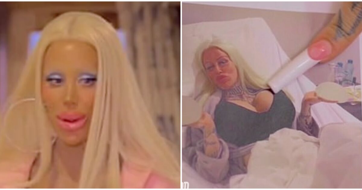 “Ho speso 250.000 dollari per essere come Barbie, sono molto contenta della mia vita e non vorrei mai che cambiasse”: la storia di Alicia “Ho speso 250.000 dollari per essere come Barbie, sono molto contenta della mia vita e non vorrei mai che cambiasse”: la storia di Alicia