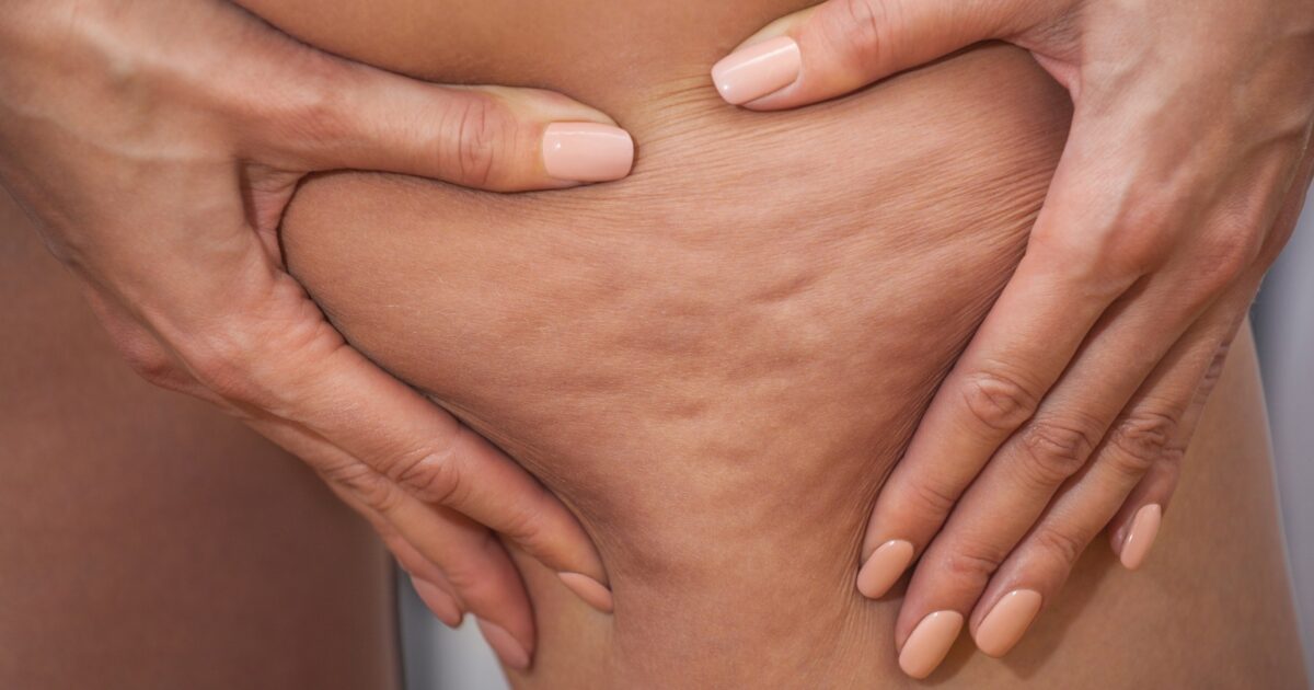 gambe pesanti con il caldo i consigli degli esperti i massaggi e i prodotti anti cellulite per coccolare il corpo in estate