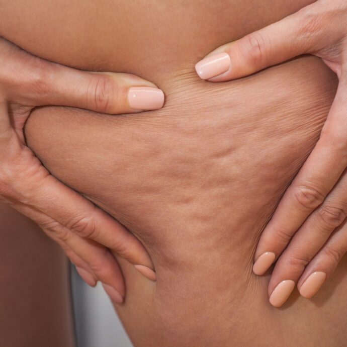 Gambe pesanti con il caldo? I consigli degli esperti, i massaggi e i prodotti anti-cellulite per coccolare il corpo in estate