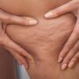 Copertina di Gambe pesanti con il caldo? Ecco i consigli degli esperti 