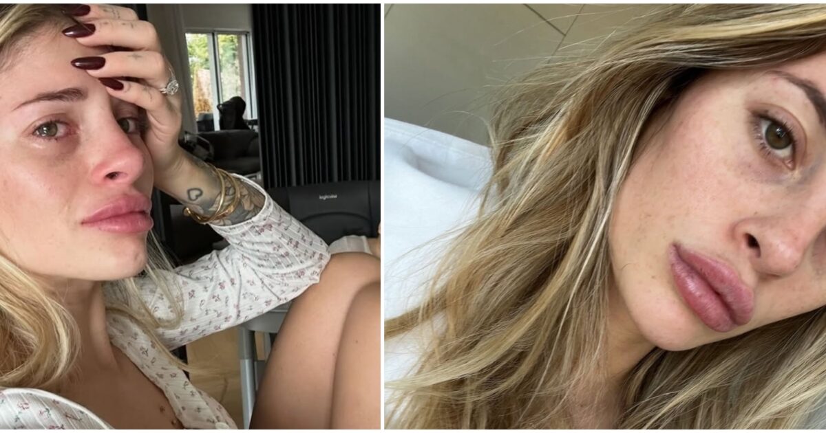 “Ero messa davvero male… Inventavo dolori perché si sa, lo stato mentale ti porta anche a dolori fisici”: Chiara Nasti in lacrime racconta la depressione post partum “Ero messa davvero male… Inventavo dolori perché si sa, lo stato mentale ti porta anche a dolori fisici”: Chiara Nasti in lacrime racconta la depressione post partum