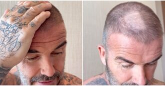 Copertina di “Stai malissimo, ma che hai combinato in testa?”: incidente casalingo per David Beckham. La moglie Victoria infierisce