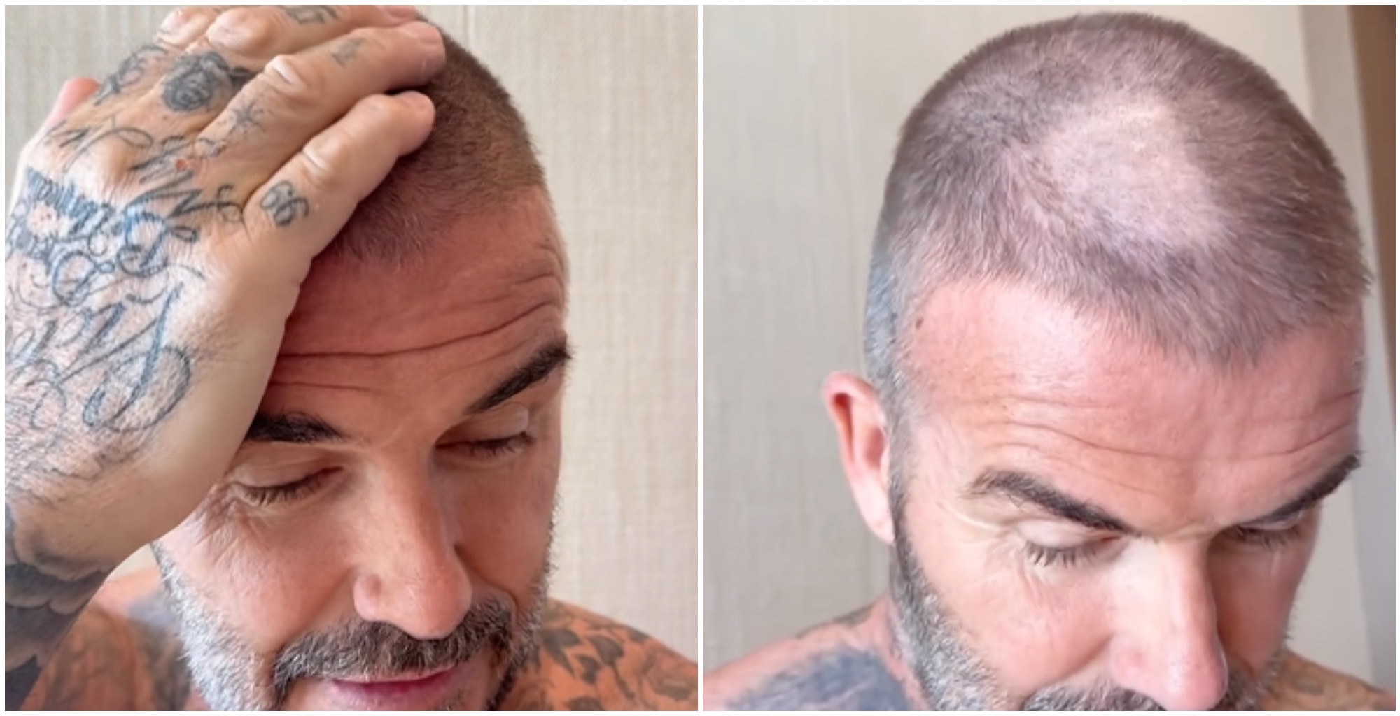 stai malissimo ma che hai combinato in testa incidente casalingo per david beckham la moglie victoria infierisce