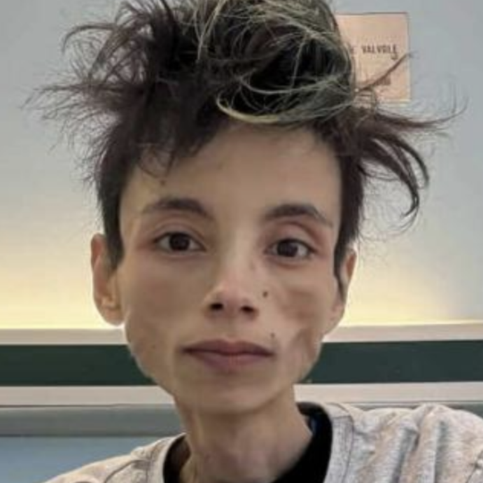 Thiago Elar morto a 27 anni, era un famoso tiktoker. Sul social raccontava la sua storia