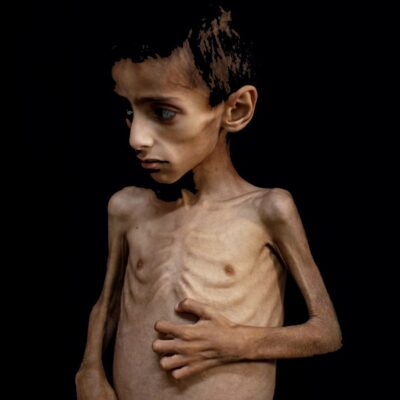 Copertina di Gaza, Francesca Albanese (Onu): “La fame è voluta e pianificata da Israele”