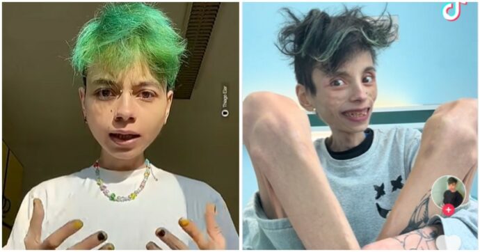 Non conosco la storia di Thiago Elar. Ma ne comprendo la dinamica: il dolore, poi la caduta