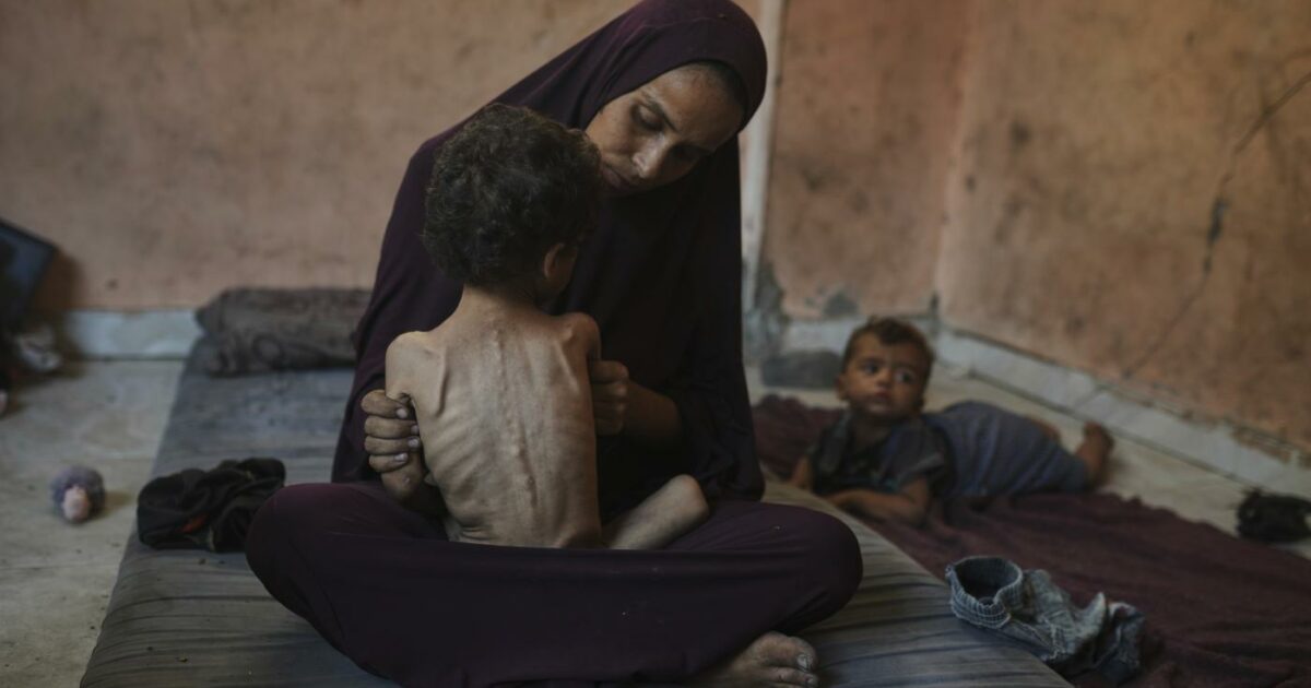 a gaza il 25 di bimbi e madri 232 malnutrito e i piccoli affamati e stremati non piangono pi249
