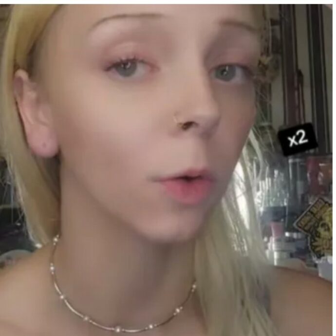 “I ragni portano rancore”: morsa da un ragno violino dopo aver provato a ucciderlo, 26enne mostra il “buco dell’orrore” che le ha lasciato sull’orecchio