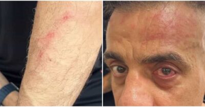 Copertina di “Mi hanno colpito con un pezzo di legno. Mi sono difeso con lo spray al peperoncino”: lo YouTuber Simone Cicalone aggredito alla stazione di Napoli