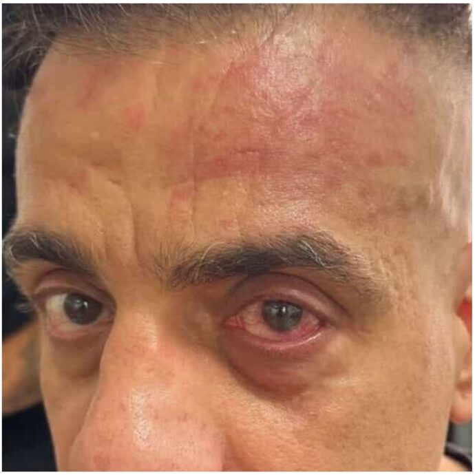 “Mi hanno colpito con un pezzo di legno. Mi sono difeso con lo spray al peperoncino”: lo YouTuber Simone Cicalone aggredito alla stazione di Napoli