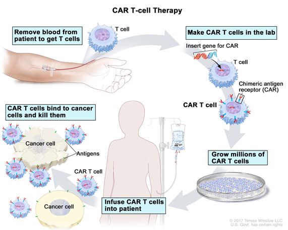 L’immunoterapia anti tumorale Car T: una promessa per i pazienti, una sfida per il servizio sanitario L’immunoterapia anti tumorale Car T: una promessa per i pazienti, una sfida per il servizio sanitario
