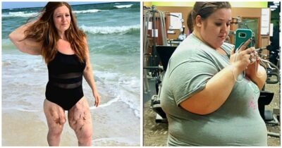 Copertina di “Ho perso 140 chili in due anni senza punture dimagranti. Non mi vergogno a mostrarmi in costume: sono grata di essere ancora viva nonostante le cicatrici e la pelle”: la storia di Lexi