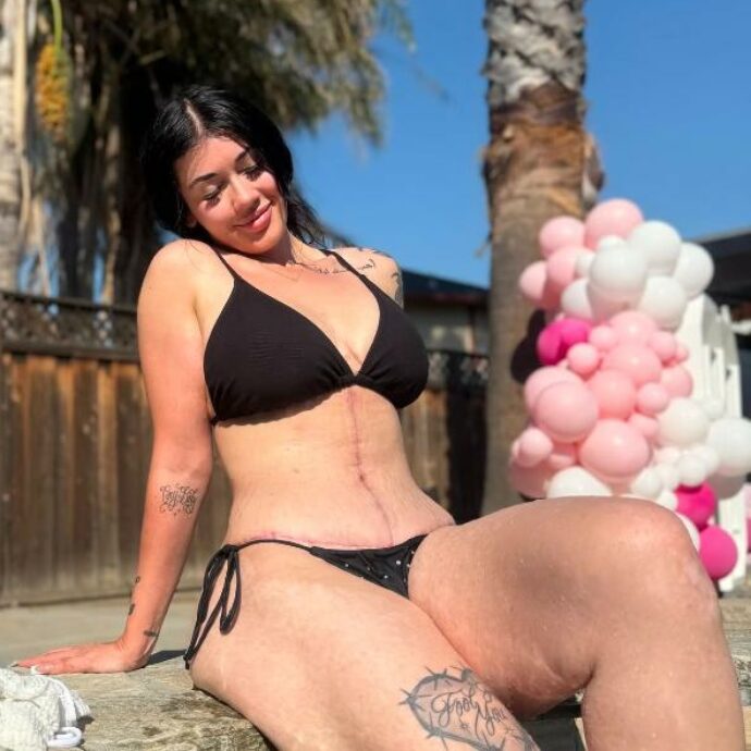 “Le mie cicatrici dell’addominoplastica paragonate a quelle di Frankestein. Il corpo non deve essere giudicato dalla società”: Natalia Aranda si sfoga