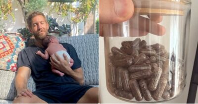 Copertina di “Le pillole di placenta sono pericolose: possono contenere virus, batteri e metalli pesanti”: parlano gli esperti dopo le foto choc di Calvin Harris