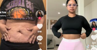 Copertina di “Il mio corpo non mi piaceva, ero insicura. Dopo un’addominoplastica e una liposuzione sulla schiena mi guardo sempre allo specchio”: la storia di Maleny