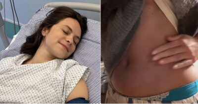 Copertina di “Ho visto il mio corpo dimagrire, gonfiarsi e patire fitte allucinanti. Mi hanno tolto un pezzo e qualcosa è cambiato”: così Francesca Michielin due anni dopo l’asportazione del rene