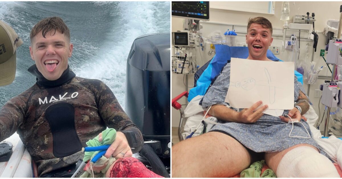 “Uno squalo toro di due metri e mezzo mi ha squarciato il ginocchio. Senza i miei amici sarei morto”: il racconto di Chad Armand