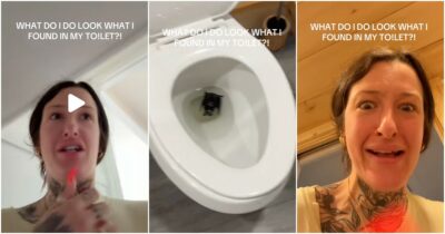 Copertina di “Sono andata in bagno e ho trovato un pipistrello che galleggiava nel water, sono corsa in ospedale”: il racconto choc di Alison Doyle