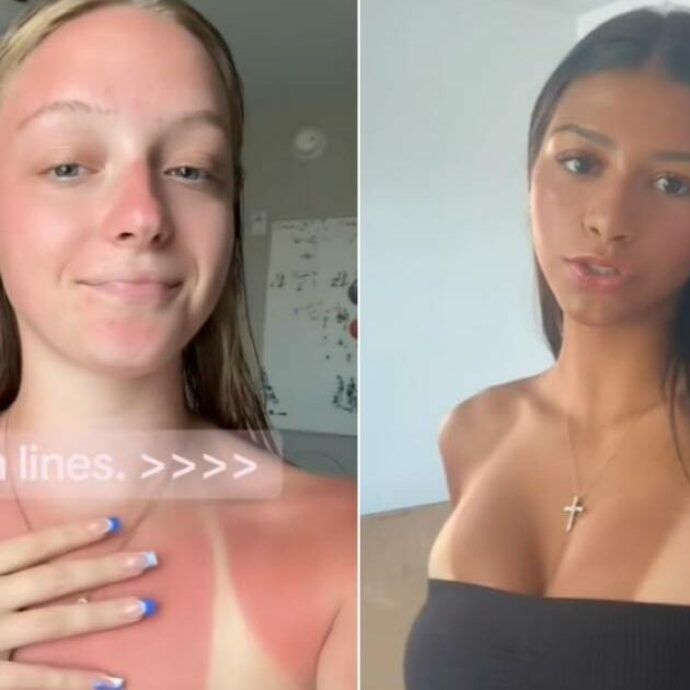 “Un pericolo per i minori, pronti a intervenire”: il Ministero della Salute contro #sunburnttanlines, la challenge di TikTok che brucia la pelle