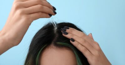 Copertina di “Può causare arresto cardiaco e morte, anche solo pochi grammi sono letali”: siero anti caduta dei capelli in vendita su Amazon ritirato dal mercato