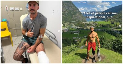 Copertina di “Il medico doveva solo svuotare una cisti e invece mi ha tagliato la gamba con il bisturi mentre ero sveglio. Vedevo l’osso, un’agonia”. Il racconto choc di Luke Tarrant