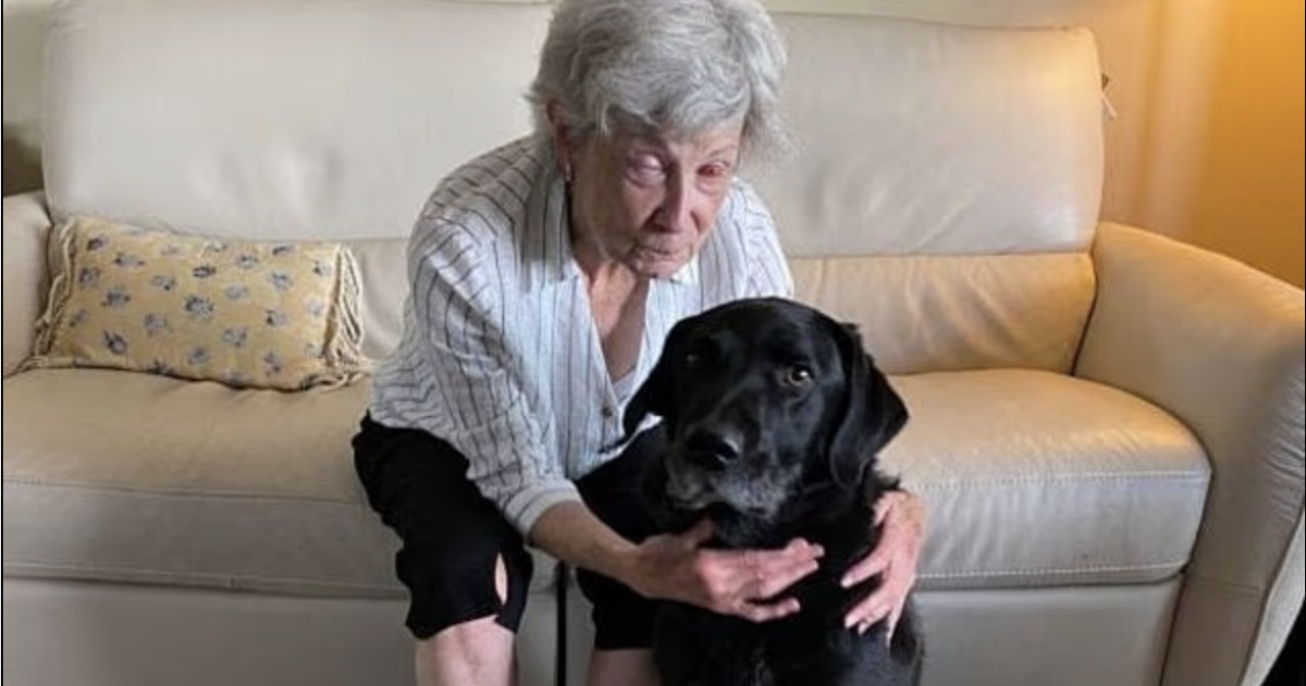 200 un miracolo 75enne cieca da 10 anni riacquista la vista grazie a un dente impiantato nell8217occhio il chirurgo 200 un8217operazione complessa e strana ma funziona