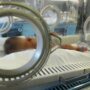 Copertina di Prima terapia genica iniettata nel cervello contro una rara forma di epilessia: il paziente è un bimbo di 8 mesi